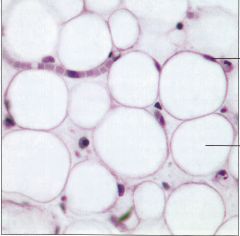 Name this cell/tissue