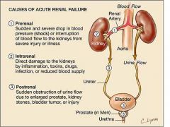 Acute kidney failure is the rapid loss of ones kidneys' ability to remove waste and help balance fluids and electrolytes in the body (rapid means less than 2 days).