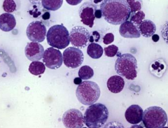 A cat presents with dyspnoea and weight loss. You perform a thoracic tap and this is what is shown under cytology.

Dx?


a) Granulomatous Lymphadenitis

b) Caseous Lymphadenitis

c) Suppurative Lymphadenitis

d) Thymic Lymphoma

e) Thymoma

f) Re...