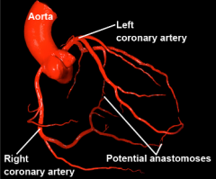 Arteries that don't link up with other arteries1. Anatomical- Single artery which does not anastamose- Occlusion = necrosis2. Functional- Artery with potential small-caliber arteriole anastomosis- Occlusion usually leads to dilation of collaterals