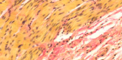 Ikke tværstribet. Styres af det autonome nervesystem. Mindre celler med cellekernen i midten.
Vækst ved forøgelse af cellestørrelse og celledeling
Findes bla. i tarme mm. Det ser gult/hvidt ud
Findes også  blodårer