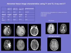Which scan is best for looking at Gray vs. white matter? Cerebral hemorrhages? Bone structure? What color would those all appear?