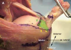 What is the avg med-to-lat dist of the supraspinatus tendon inser @ its ftprint on the grtr tuberty? 1-6-8mm; 2-14-16mm; 3-20-22mm; 4-24-26mm;5-30-32mm