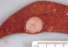 Commonly seen in older dogs, this is a what in this liver?