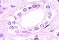 - Cuboidal to columnar epithelium
- Distinct cell borders
- Many, centrally located nuclei
- Pale staining cytoplasm