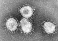 Name this family of virus