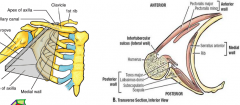 Medial wall: Ribs, serratus anterior
Lateral wall: Intertubecular sulcus
Anterior wall: Pectoralis Mj. and Mn.
Posterior wall: Scapula and muscles (subscapularis, LD, Teres Mj.)