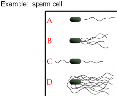 helps entire cell move from one place to another
 
 
*Analogy= legs