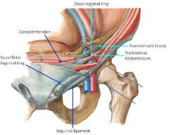 the inferior arch of the transversalis or conjoint tendon is approximated to the shelving portion of the inguinal ligament. Used for simple, indirect hernias, including inguinal hernias in women 