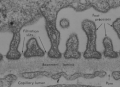 - Consists of epithelial cells called Podocytes because of their primary and secondary foot processes (pedicles)
- Pedicles inter-digitate along glomerular BM
- Space between pedicles is the filtration slit (25-40 nm) and bridged by electron den...