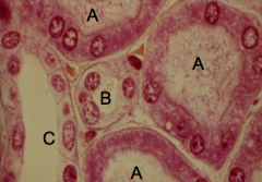 What tubule is labeled A?