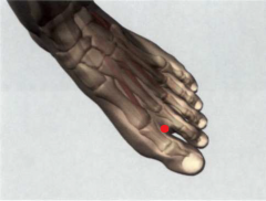 entre la primera y la segunda articulación

metatarsofalángica, en el borde de la piel interdigital

entre el primer y el segundo dedo del pie, en el límite

entre la carne roja y la blanca