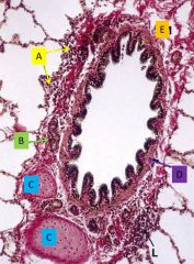 Intrapulmonary bronchus - identify and describe - what is in the lamina propria?