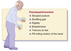 Pseudoparkinsonism, which resembles symptoms of Parkinson's disease, is a major side effect of typical antipsychotic drugs. Symptoms of pseudoparkinsonism, or EPS, include stooped posture, masklike facies, rigidity, tremors at rest, shuffling gait, pill-r