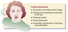 Tardive dyskinesia is a serious adverse reaction occurring in clients who have taken a typical antipsychotic drug for more than a year. The likelihood of developing tardive dyskinesia depends on the dose and duration of the antipsychotic factor. Character