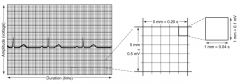 Electrocardiographic waveforms are measured in amplitude (voltage) and duration (time).
