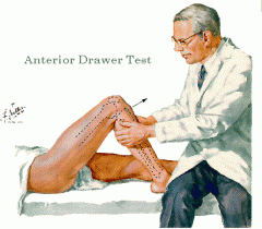 Indication: ACL/PCL tears 
Pt. supine, knees flexed to 90, feet flat on table. 
Dr. sits on feet. Cup hands around patient's knee with fingers on area of insertion of medial and lateral hamstrings. Thumbs on medial and lateral joint lines. 
+Anterior: 