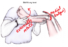 Indication: Meniscal tears & MCL 
Pt supine
Dr. holds patient's ankle. Flexes leg fully. Place other hand over knee with thumb and thenar eminence over lateral joint line. Contact medial joint line with remaining fingers. 
Apply a MEDIAL/VALGUS stress 