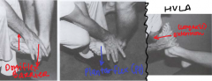 Dorsiflexion of the talus = Restriction 
Pt sits on edge of table, feet dangling. 
ME - Dr. sits in front of dysfunctional talus. Place medial hand under plantar surface of forefoot with web of lateral hand overlying neck of talus. DORSIFLEXION BARRIER 