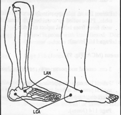 Peroneus Longus & Brevis 
Anteroinferior to LATERAL MALLEOLUS. 
Pt prone on TP side with ankle off table. Lateral malleolus rests on rolled towel. 
EVERT from medial foot. Up to 50# of force. Fine tune with external rotation.