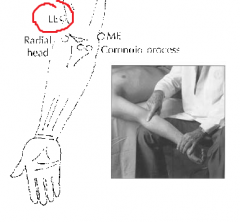 Between radial head and lateral epicondyle? 	Pt supine
Extend, Supinate, Abduct
E-Sup-AB