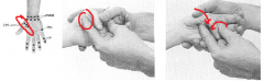 Thenar eminence of the palmar surface of the first metacarpal 	Flex or oppose thumb over tender point. Fine tune with abduction/adduction, internal/external rotation