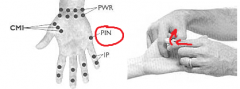 Palm of hand, medial and lateral sides of shafts of metacarpals	Flex fingers over tender points. Fine tune with lateral flexion toward tender point and rotation.