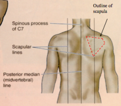 Posterior median (mispinal or midvertebral) line- vertical line through spinous process of vertebrae in mid-saggital plane

Scapular lines- vertical lines that pass through inferior angles of the scapula, line is parallel to the posterior median line