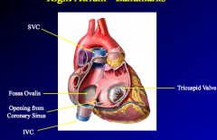Right Atrium
SVC/IVC openings, opening coronary sinus, fossa ovalis (closed off at birth), tricuspid valve
