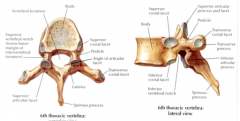 Vertebral (neural) arch= pedicles and lamina

clinically- spina bifida