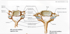 Cervical Vertebrae (typical C3-C7, smallest vetebrae)

Body- small, wider side to side than ant-post

Vertebral foramen- LARGE, triangular

TPs- have transverse foramen, allow vertebral artery to pass through (C6-1), C7 may have small or absent

A