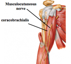1.	Coracobrachialis
a.	Proximal attachments
•	Coracoid process of scapula
b.	Distal attachments
•	Middle third of medial humerus 
c.	Musculocutaneous nerve
d.	Flex and adduct arm
e.	Misc.
•	Musculocutaneus nerve pierces through coracobrachialis