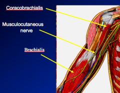 2.	Musculocutaneous nerve
a.	Begins inferior border of pec minor
b.	Pierces coracobrachialis
c.	Travels between biceps brachii and brachialis
d.	After innervation of biceps and brachialis the nerve becomes lateral cutaneous nerve of the forearm
