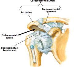 Glenohumeral Joint (GH) (pages 788-795)
a.	humeral head articulates with glenoid cavity of humerus
b.	glenoid labrum increases congruency of the joint
c.	ligaments of the GH joint
•	glenohumeral ligaments (strengthen anterior aspect of joint)
(i)	sup