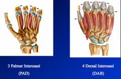 Interossei muscles (located between the metacarpals)
4.	all are innervated by the ulnar nerve
5.	four dorsal interossei
a.	ABduct the digits with the midline of the hand
6.	three palmer interossei
a.	ADduct the digits with the midline of the hand
7.