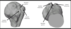 Median N, Brachial artery and veins and basilic vein, medial cutaneous antebrachial nerve and ulnar N. medially.