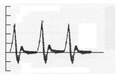 What are two main characteristics of a Triphasic waveform?