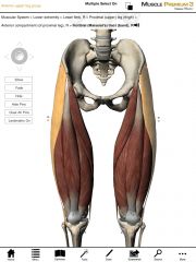 What is the origin and insertion of the Tensor Fascia Latae (TFL)?  (with iliotibial band)