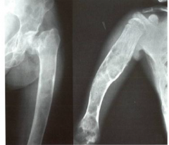 What does this x-ray depict?