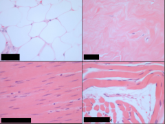 What tissue types are each of these?