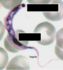 What parasite is this? What is labeled in the image? What are the 2 strains and where are they native?

What is there unifying feature?