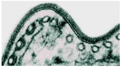 What is this image of trypanosomiasis depict?