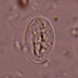 What parasite is depicted here? What phase of its life cycle is it?