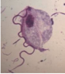 What pathogen is this?