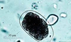 Microscopic examination of feces for eggs