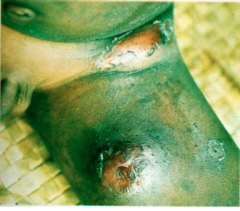 What disease is this? What are the clinical findings?