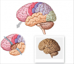 - frontal lobe, parietal lobe, temporal lobe, occipital lobe
- fifth lobe, insula, medial to lateral sulcus
