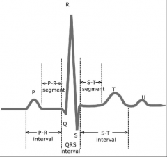 - P wave is depolarization of SA node through atria
- QRS is ventricular depolarization 
- covers atrial depolarization as well
- T wave is ventricular repolarization