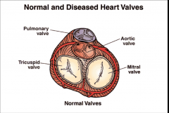 - pulmonary valve
- tricuspid valve
- aortic valve
- mitral valve