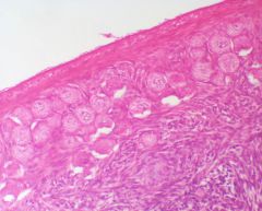 Name the three distinct tissue types in this picture from outer to inner